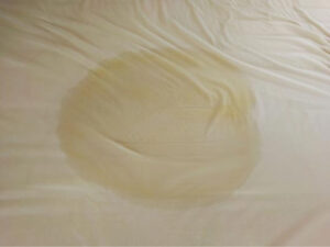 Why Dried Urine Is Tough to Remove