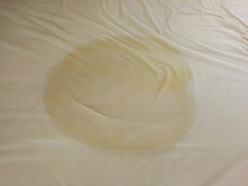 Why Dried Urine Is Tough to Remove